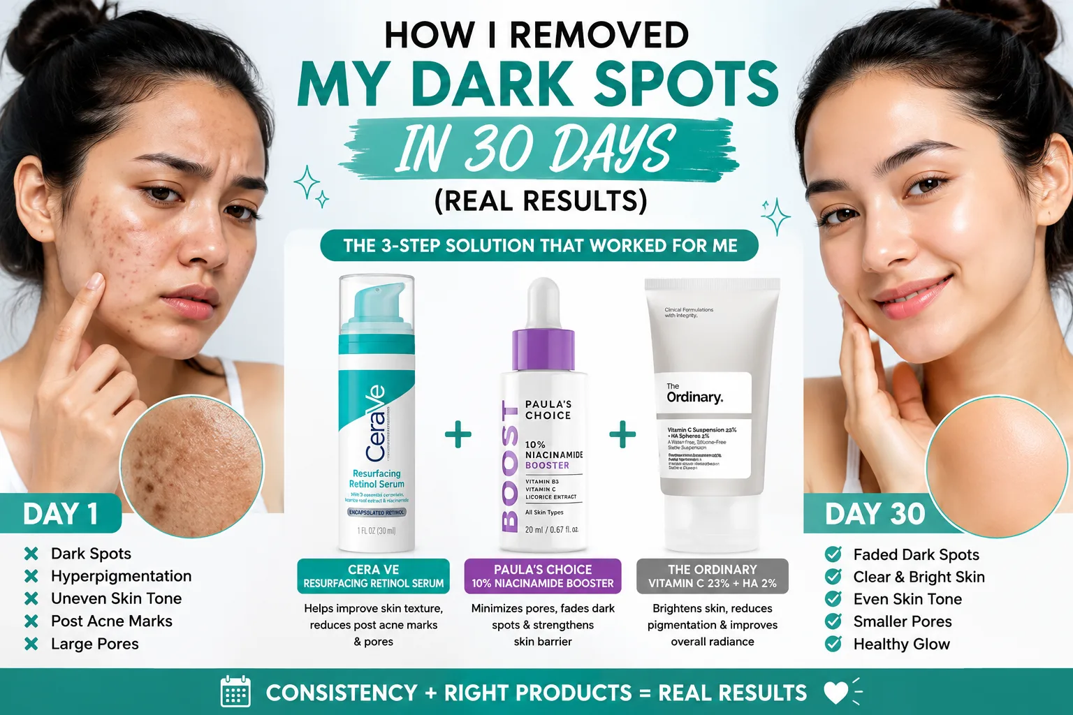"Before and after 30 day dark spot fading results using vitamin C niacinamide skincare routine for hyperpigmentation"