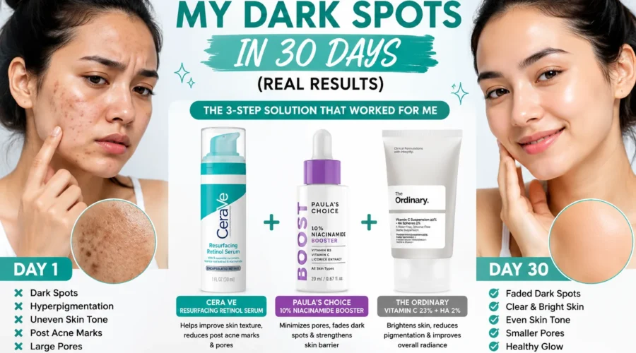 How To Fade Dark Spots: My 30-Days Skincare Routine